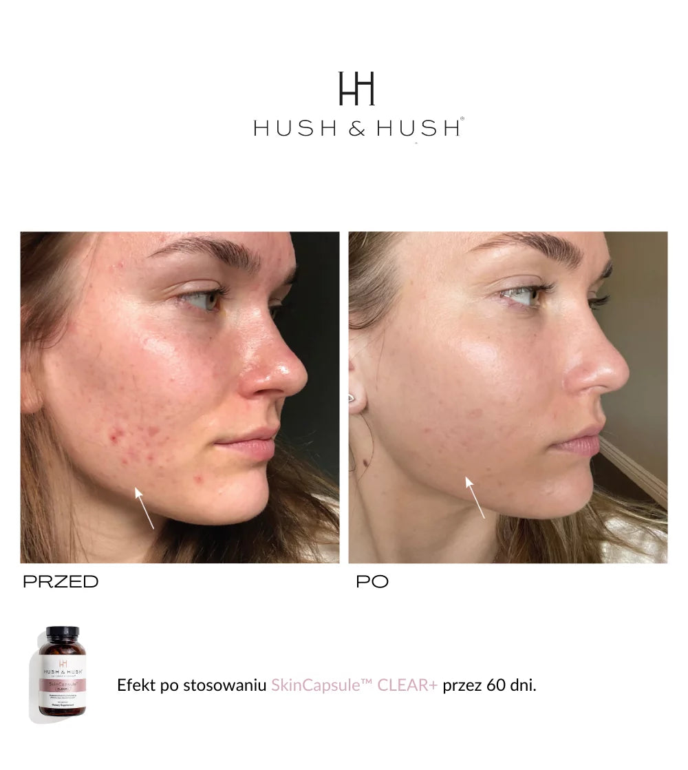 HUSH & HUSH - SkinCapsule CLEAR+ Suplement dla skóry trądzikowej 60 kap.
