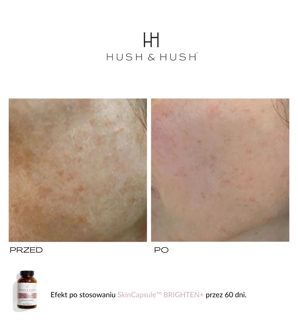 HUSH & HUSH - SkinCapsule BRIGHTEN+