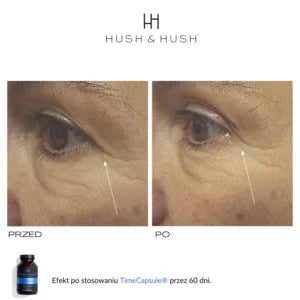 HUSH &amp; HUSH - TimeCapsule™ Antyoksydacyjny i przeciwstarzeniowy suplement diety 60 kap