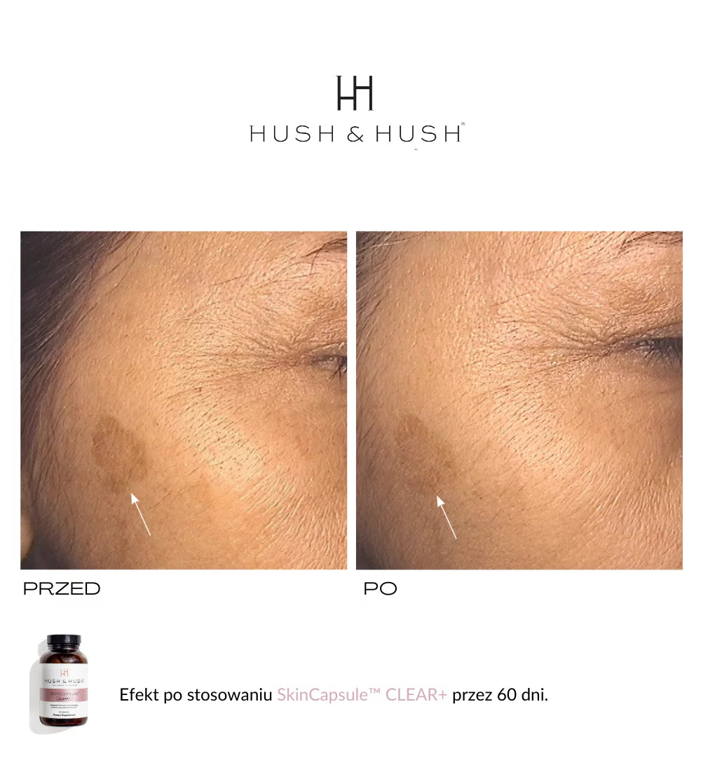 HUSH &amp; HUSH - SkinCapsule CLEAR+ Suplement dla skóry trądzikowej 60 kap.
