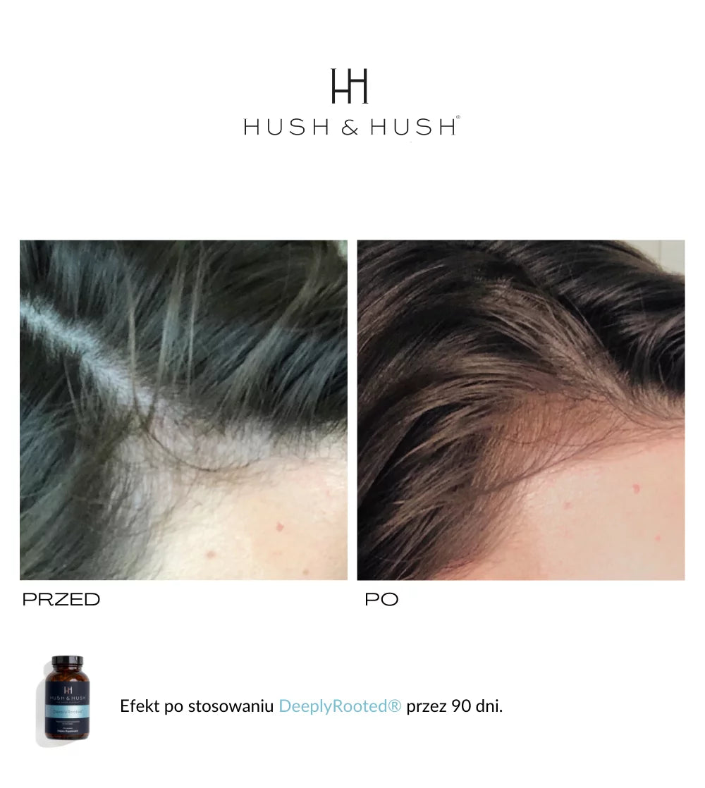 HUSH &amp; HUSH - DeeplyRooted™ Naturalny Suplement na Wypadanie Włosów i Wzrost 120 kap.