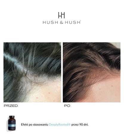 HUSH &amp; HUSH - PlantYourDay Wegański suplement diety wspierający pracę jelit 402 g