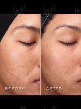 Medik8-Press&Clear-Tonik-zluszczajacy-z-kwasami-BHA-i-lagodnym-2%-kwasem-salicylowym 150ml-6